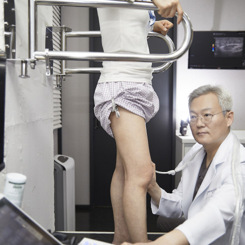 Summer: A Season of Discomfort for Varicose Vein Patients