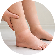 Swelling