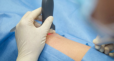 Minimally invasive endovenous laser treatment