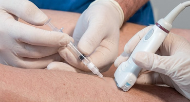 Ultrasound-guided sclerotherapy